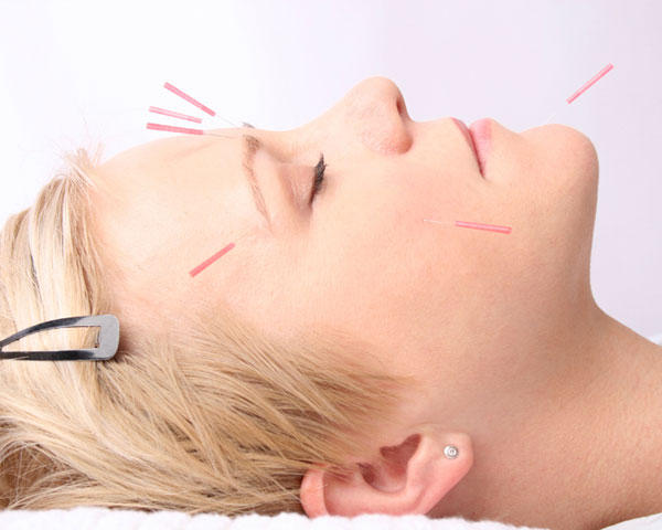 Bright Acupuncture