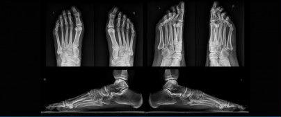 Precise Podiatry: Corio