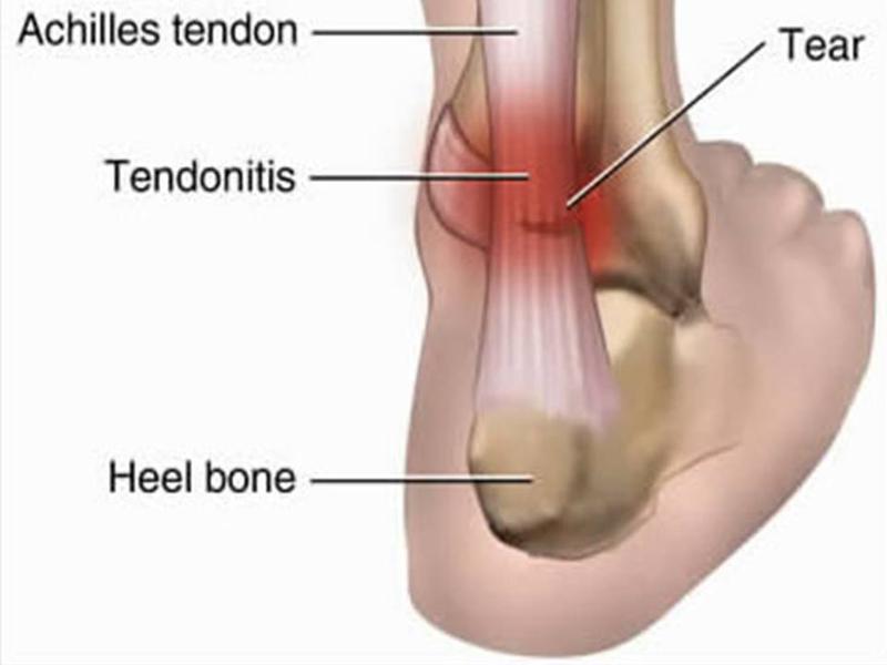 The Podiatry Group: Warragul