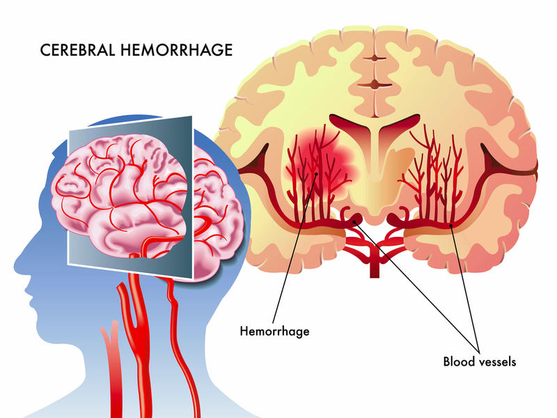 Klint Intensive Neuro Therapies