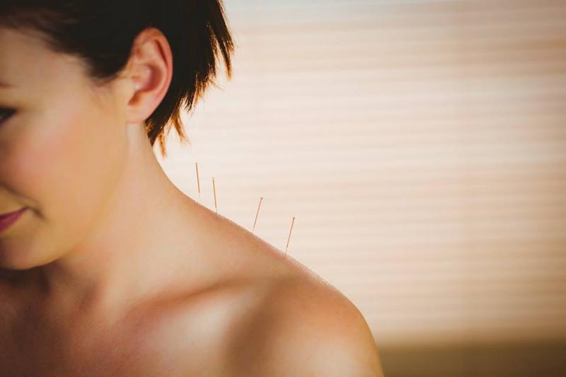 The Acupuncture Guy: Ashgrove