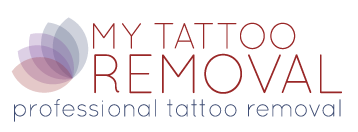 My Tattoo Removal
