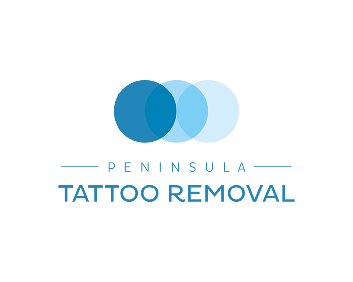 Peninsula Tattoo Removal