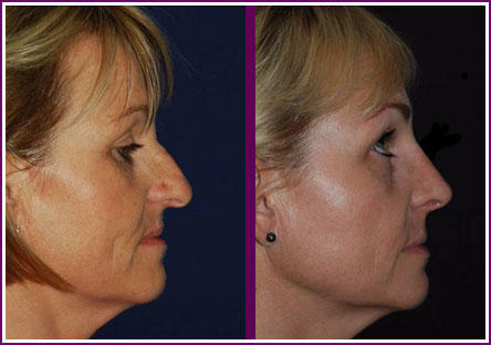 The Face Institute