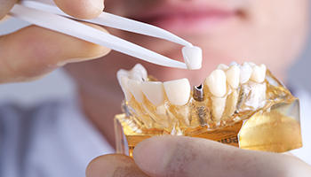 Chatswood CBD Dental