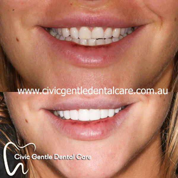 Civic Gentle Dental Care