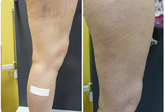 Vein Solutions Medical Clinics: Narre Warren