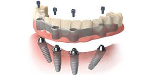 Dr Helen's Dental & Implant Studio