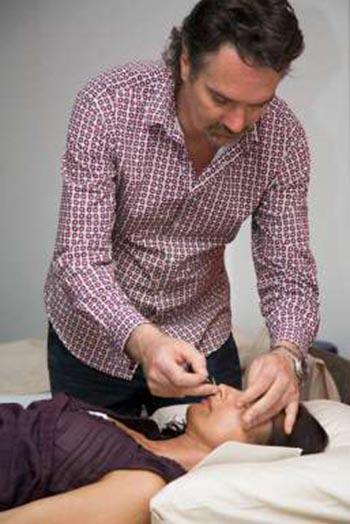 Experience Acupuncture