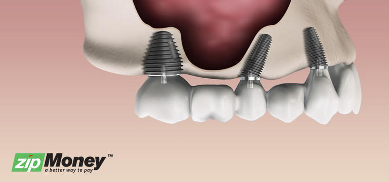 Dentistry Plus: Leederville