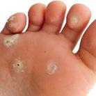 Chesterfield Podiatry