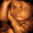Baby to Be: Caulfield South