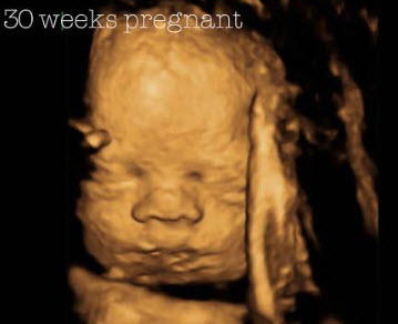 Baby Home Image
