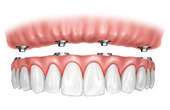 Pain Free Dentist Sydney Pty Ltd: Rozelle