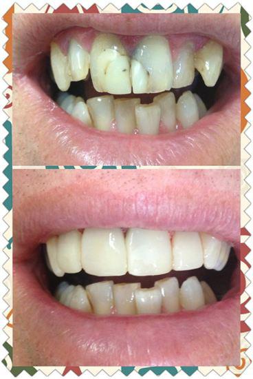 Your Dentist Gunnedah