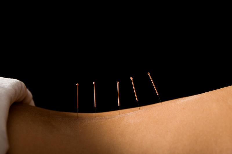 Peninsula Acupuncture and Natural Medicine: Frankston