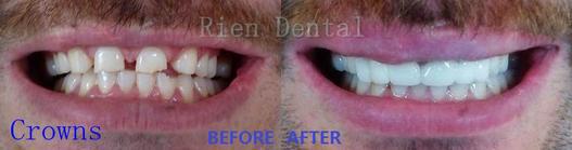 Rien Dental