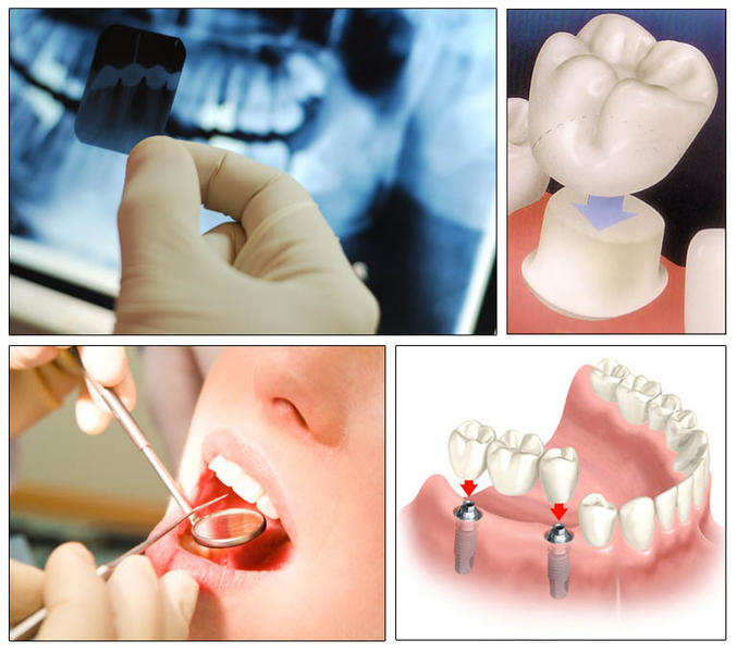 Bupa Dental: Morphett Vale