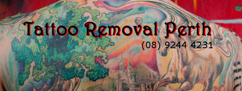 Tattoo Removal Perth