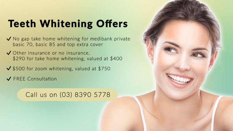 Smart Smile Dental