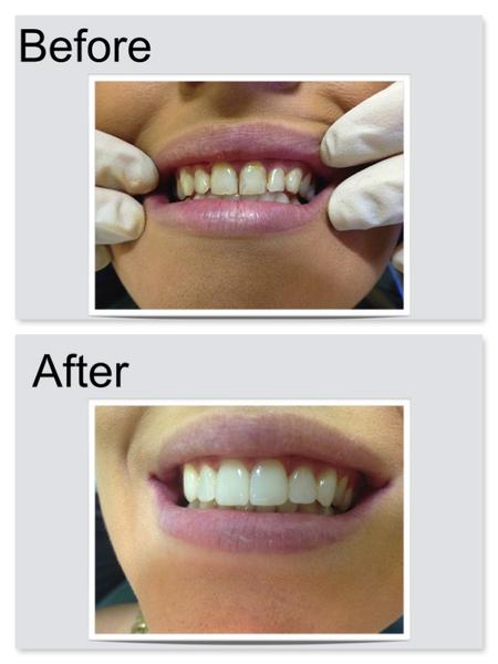 Heasley Dental