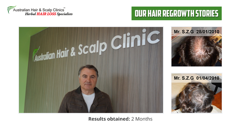 Australian Hair & Scalp Clinic: Brisbane
