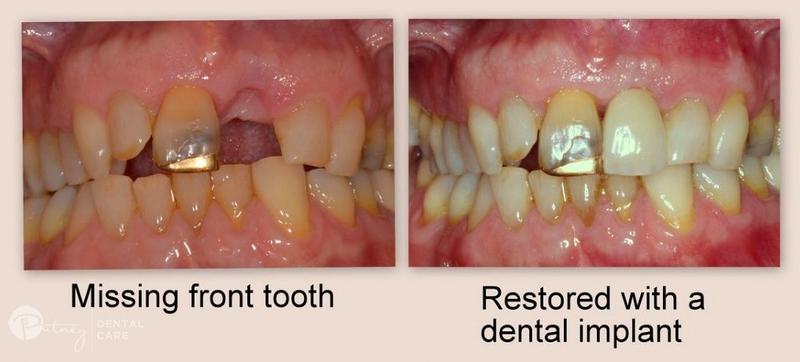 Putney Dental Care