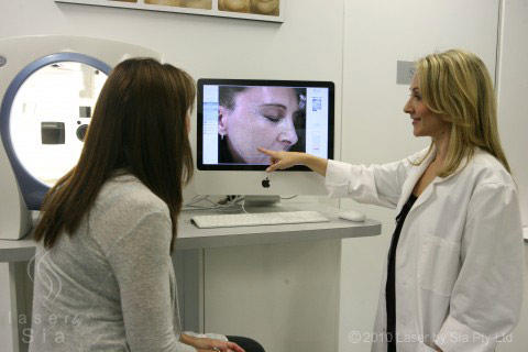 Teeth Whitening by Sia: Castle Hill