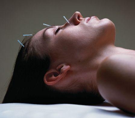 Acupuncture & Beauty Centre: Sydney
